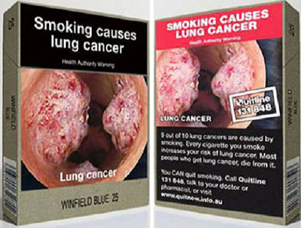 Курение — причина рака лёгких