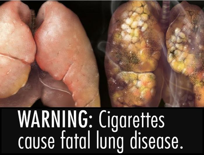 ВНИМАНИЕ: Сигареты являются причиной смертельной болезни легких